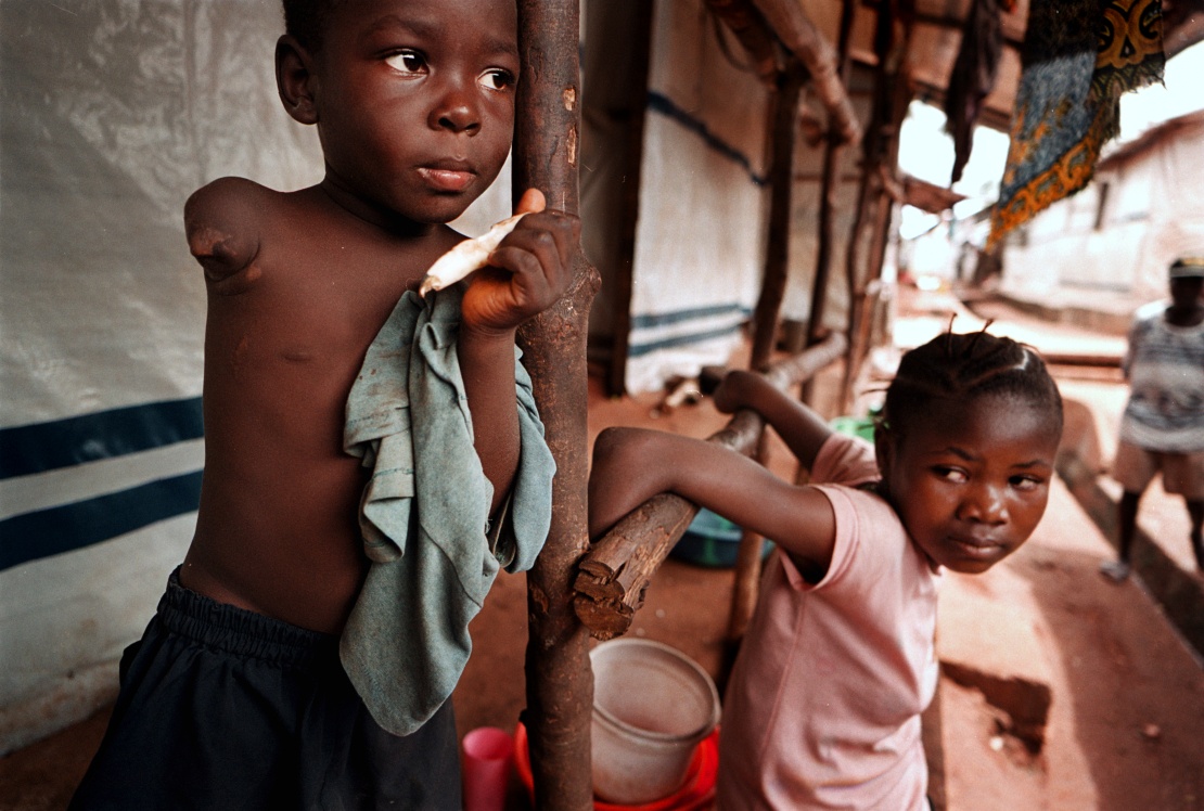 During the war in Sierra Leone, militants chopped off peopleʼs limbs, even of small children.