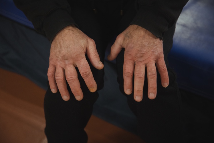 Кириченка виділяють великі й ніби набряклі кулаки з виразними пʼястковими кістками.