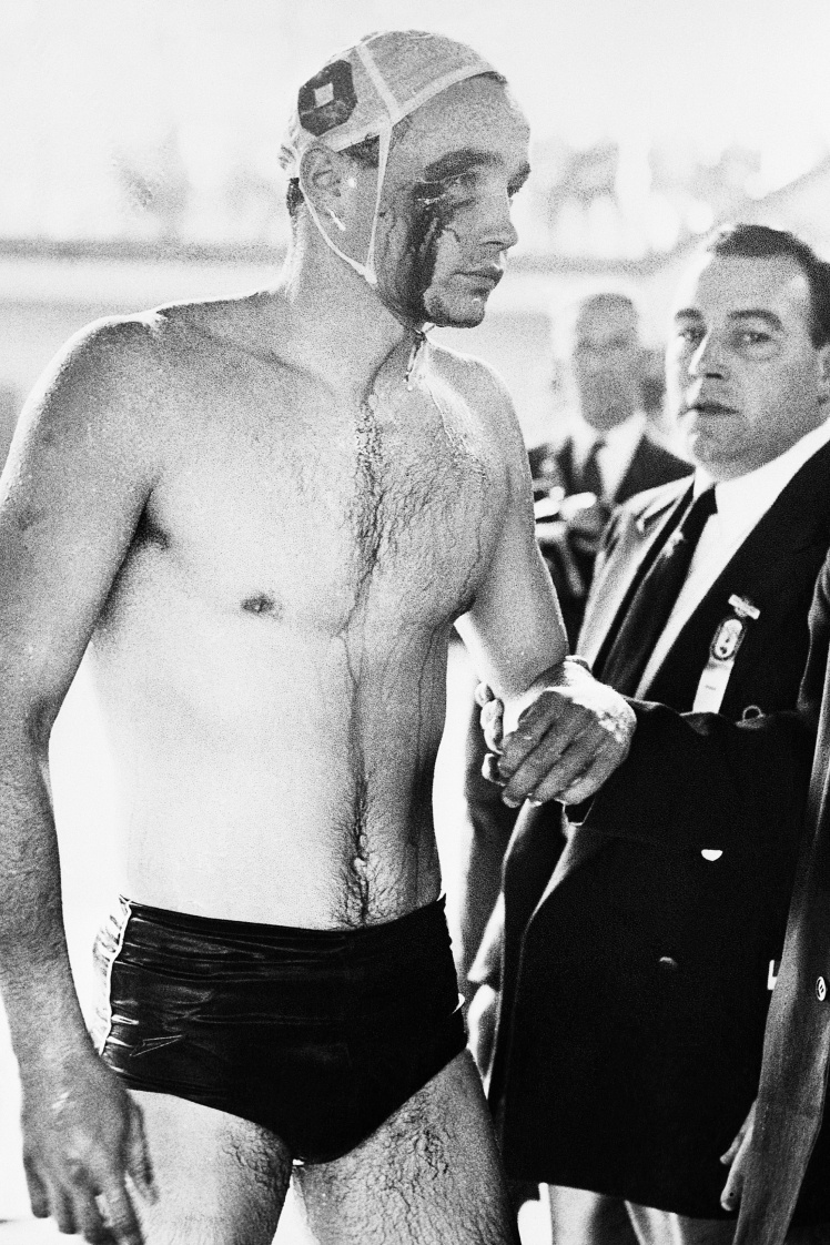 Закривавлений угорський ватерполіст після матчу з радянськими спортсменами на Олімпіаді в Мельбурні, 8 грудня 1956 року.