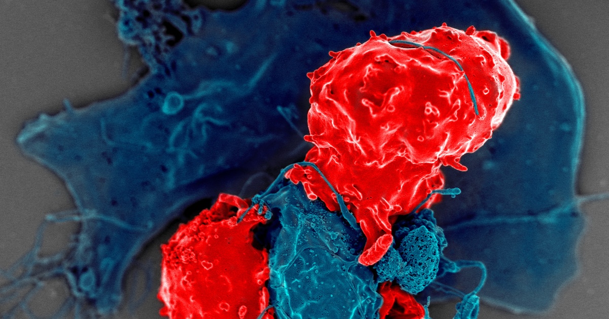 Norwegian man with HIV goes into remission after receiving cell transplant from brother — initially treated for cancer