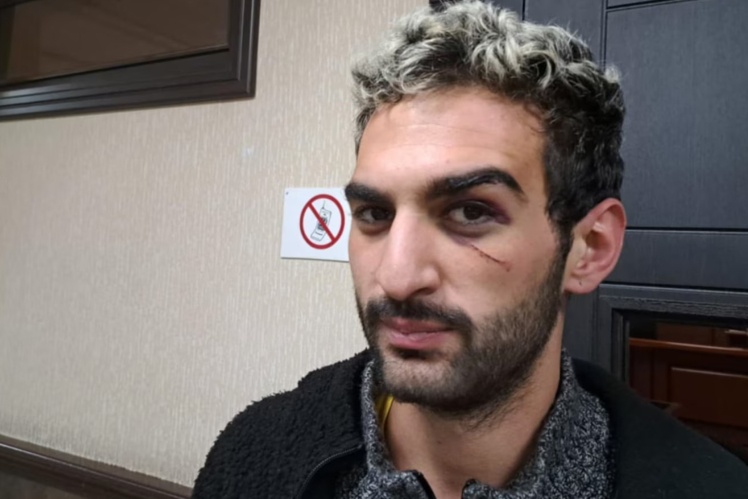 Активіст Ніка Данелія — його поліція затримала і побила під час тих самих протестів. Данелія каже, що били близько 15 людей, поки він лежав на землі. Суд призначив йому 2 500 ларі ($930) штрафу.