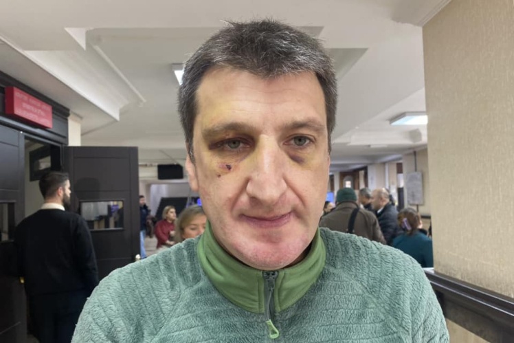 Іраклій Цулая — засновник медіаплатформи «Холон» і член опозиційної партії «За Грузію». На протестах у листопаді 2024 року поліція затримала і побила його. За «непокору поліції» суд призначив Цулая 3 тисячі ларі ($1 100) штрафу.