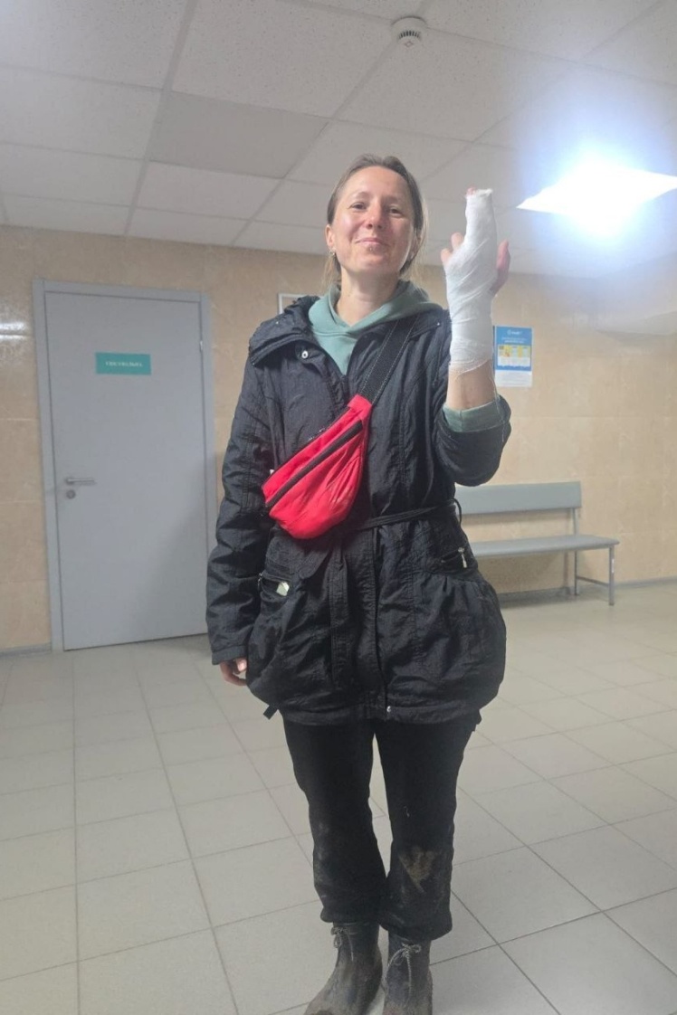 У неї діагностували травму руки і наклали гіпс.