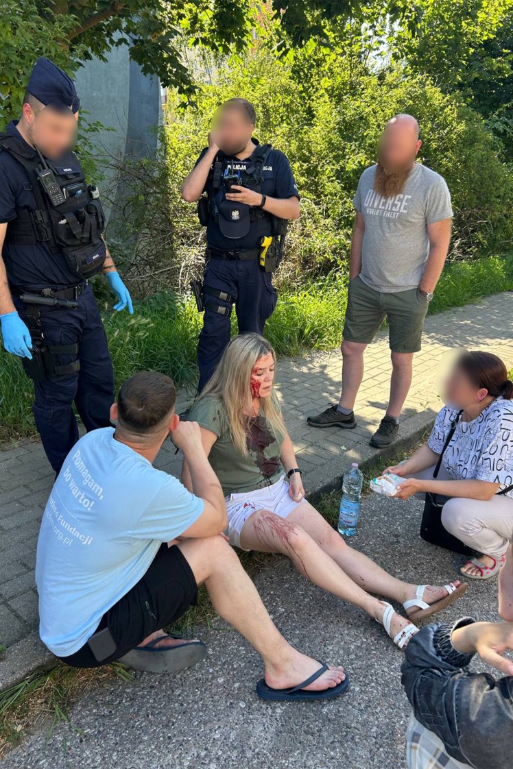 Алла Кондратенко після нападу.