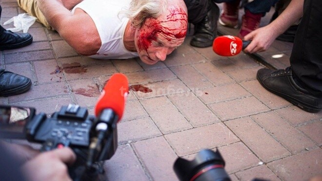 Полиция побила и задержала ветерана, который залез на ограду на Майдане