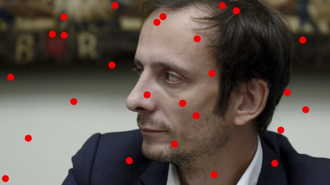 Итальянский политик, который критикует вакцинацию, подхватил ветрянку