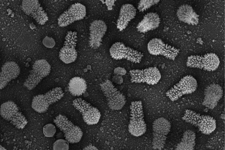 Гігантський вірус. В добірку потрапив вірус Tupanvirus, нещодавно виявлений у амеб. У нього найдовший набір генів, які виробляють білок і найдовший хвіст.