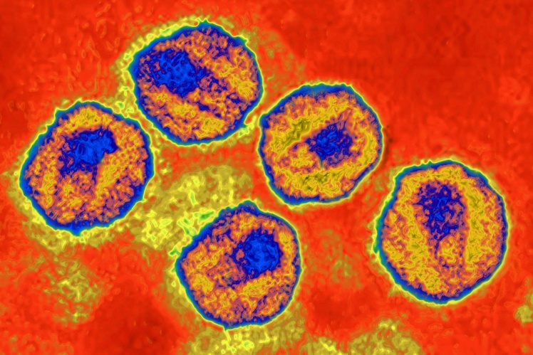 Так вірус імунодефіциту людини виглядає під мікроскопом.