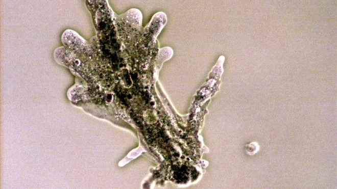 Из-за климатических изменений в США распространяется смертельно опасная амеба, разъедающая мозг