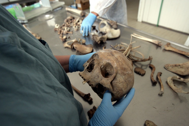 Судовий антрополог Лаура Язеджян з Канади досліджує череп у проектному центрі по ідентифікації зниклих безвісти   13 липня 2005 року в Тузлі, Боснія і Герцеговина.