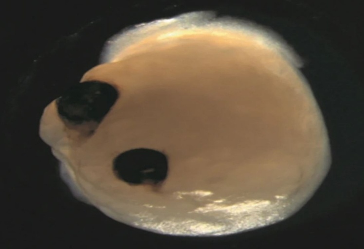 Органоїд мозку з очними бульбашками